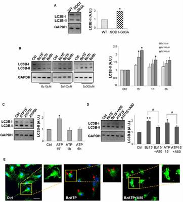 P2X7 Receptor Activation Modulates Autophagy in SOD1-G93A Mouse Microglia